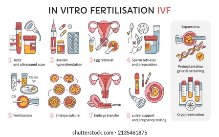 Vô Sinh Có Con Được Không? 10 Giải Pháp Kỳ Diệu Y Học Hiện Đại 3 Vitro Fertilization Ivf Vector Infographic Infertility Stock ...